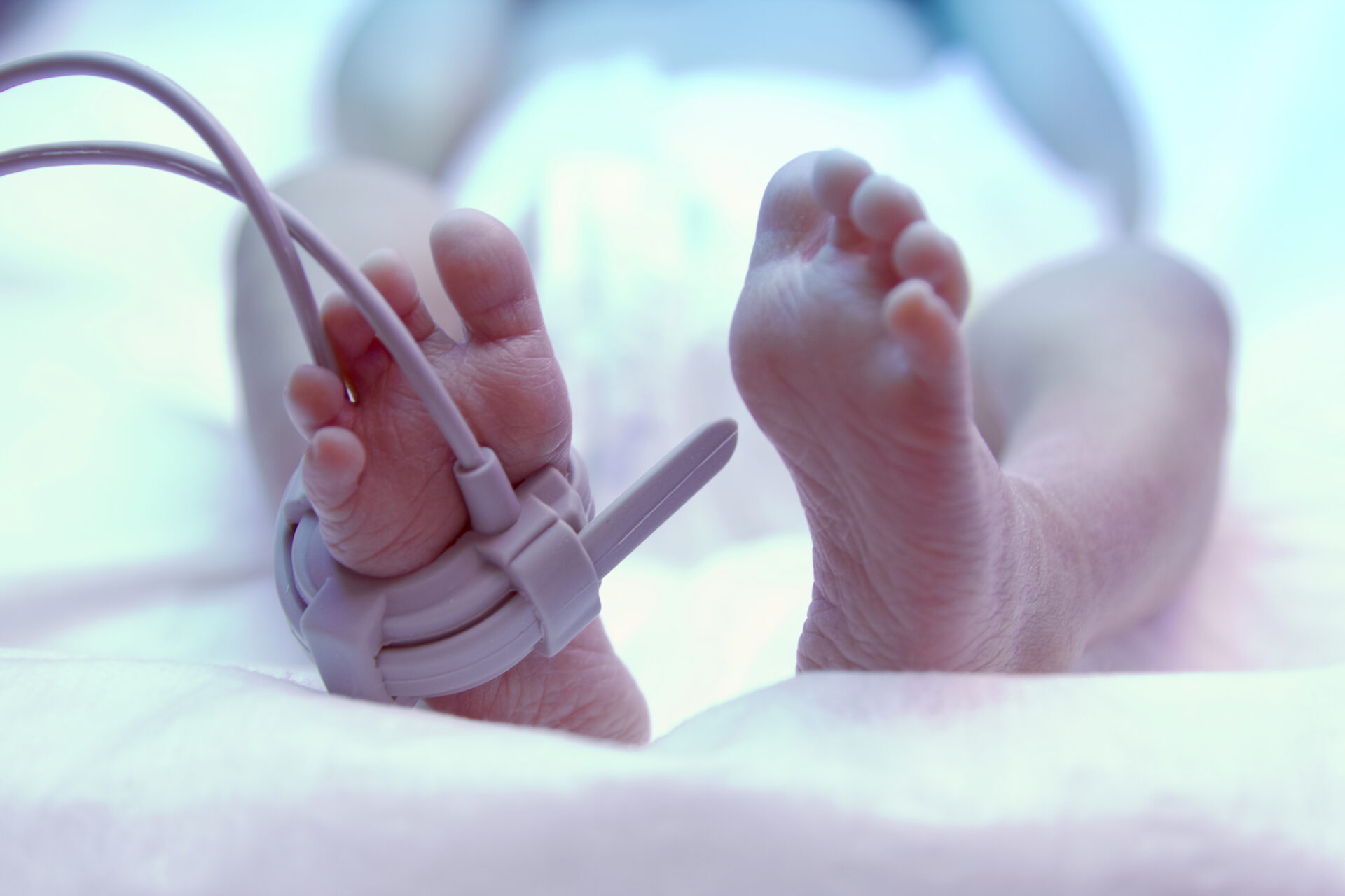 A close-up image of a newborn baby's feet, with one foot gently secured by a medical sensor, often used in neonatal monitoring. The soft lighting and delicate features of the infant emphasize the tender care provided in a clinical setting, symbolizing both vulnerability and strength in early life.